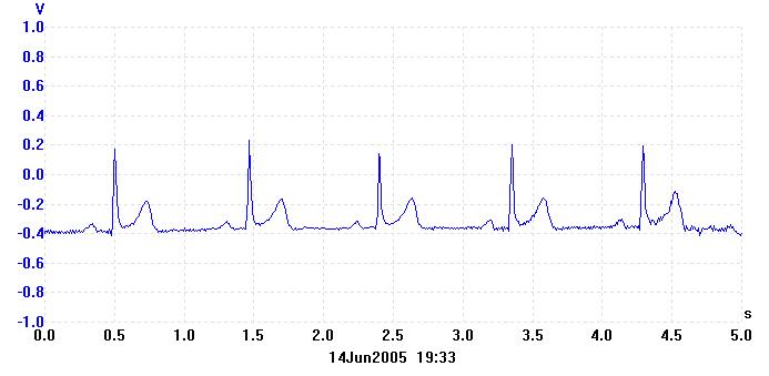 ECG_04.jpg